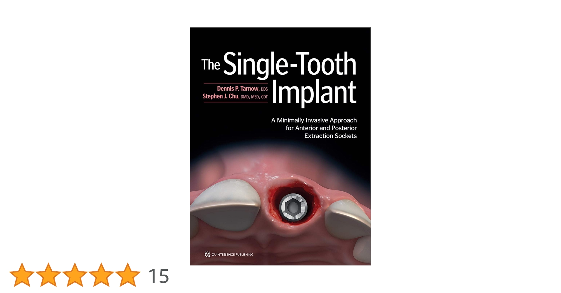 The Tooth Preparation※裁断済 書籍詳細「The Tooth Preparation」 | フォルディネット